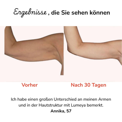 Lumeya™ Infrarotlicht Armbänder